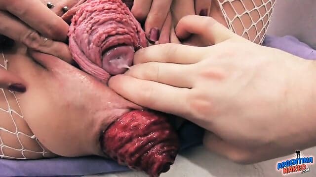 Hardcore and prolapse